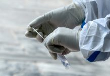 Sociedad Venezolana de Infectología pide aumentar pruebas gratuitas para COVID-19
