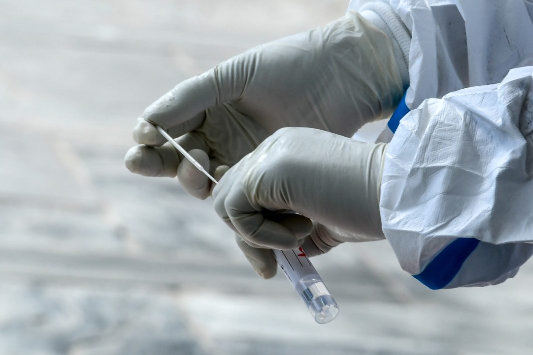 Sociedad Venezolana de Infectología pide aumentar pruebas gratuitas para COVID-19