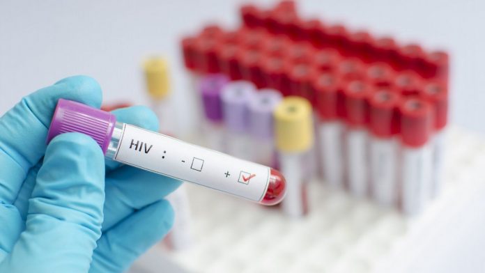 Urge que gobierno adquiera antirretrovirales para pacientes con VIH
