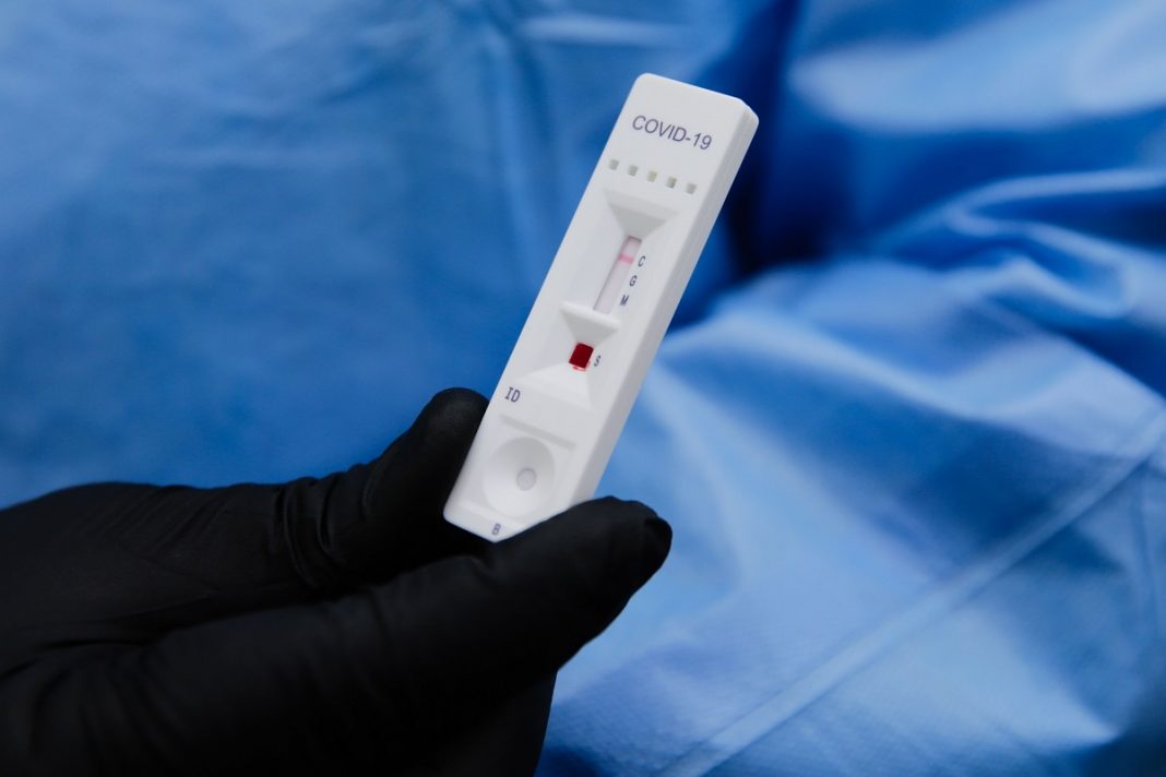 El país registró mil 346 nuevos contagios de COVID, según cifras oficiales