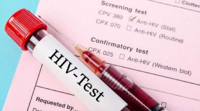 Diagnóstico del VIH