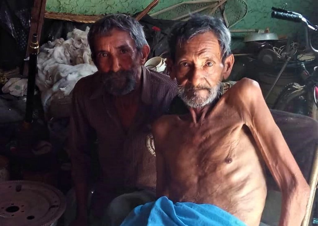 Servicio Público: Abuelo con pierna amputada necesita ayuda médica
