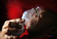 Infección respiratoria en la niñez, ligada a mayor riesgo de muerte prematura