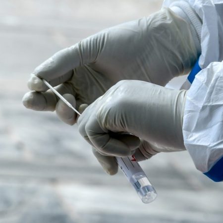 Sociedad Venezolana de Infectología pide aumentar pruebas gratuitas para COVID-19