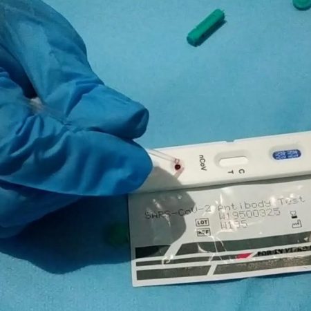Carabobo reporta siete nuevos contagios de COVID en las últimas 24 horas