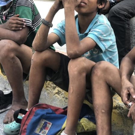 Desnutrición en Venezuela (Foto Referencial)
